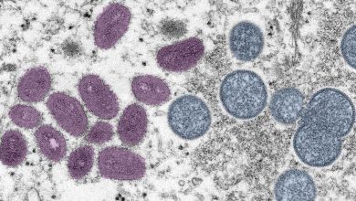 Mpox: Los casos bajan un 90% en tres meses, pero el virus sigue transmitiéndose en algunos países