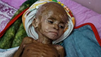 Las muertes infantiles por emaciación son previsibles y evitables