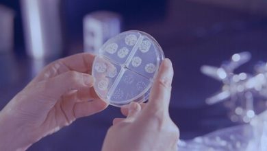 Adiós al recalentado de mole: esta microbióloga explica por qué es mala idea comer arroz recalentado